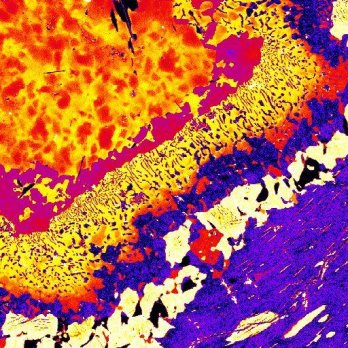 False color, 2-dimensional image from scanning electron microprobe showing calcium concentrations in garnet. Brightly colored splotches in purple, orange, and yellow hues